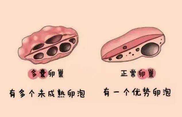 广州代孕技术哪家强|杭州助孕机构供卵试管受精，新鲜胚胎和囊胚哪个着床更