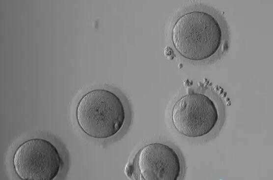 广州代怀孕供卵试管 2022广州供卵试管婴儿明细 ‘b超下的球球是男孩吗’